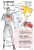 Infográficos sobre el Zika_19