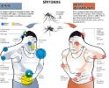 Infográficos sobre el Zika_22